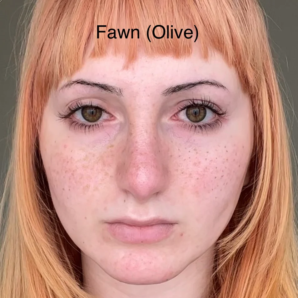Freckle Pen - Image 4