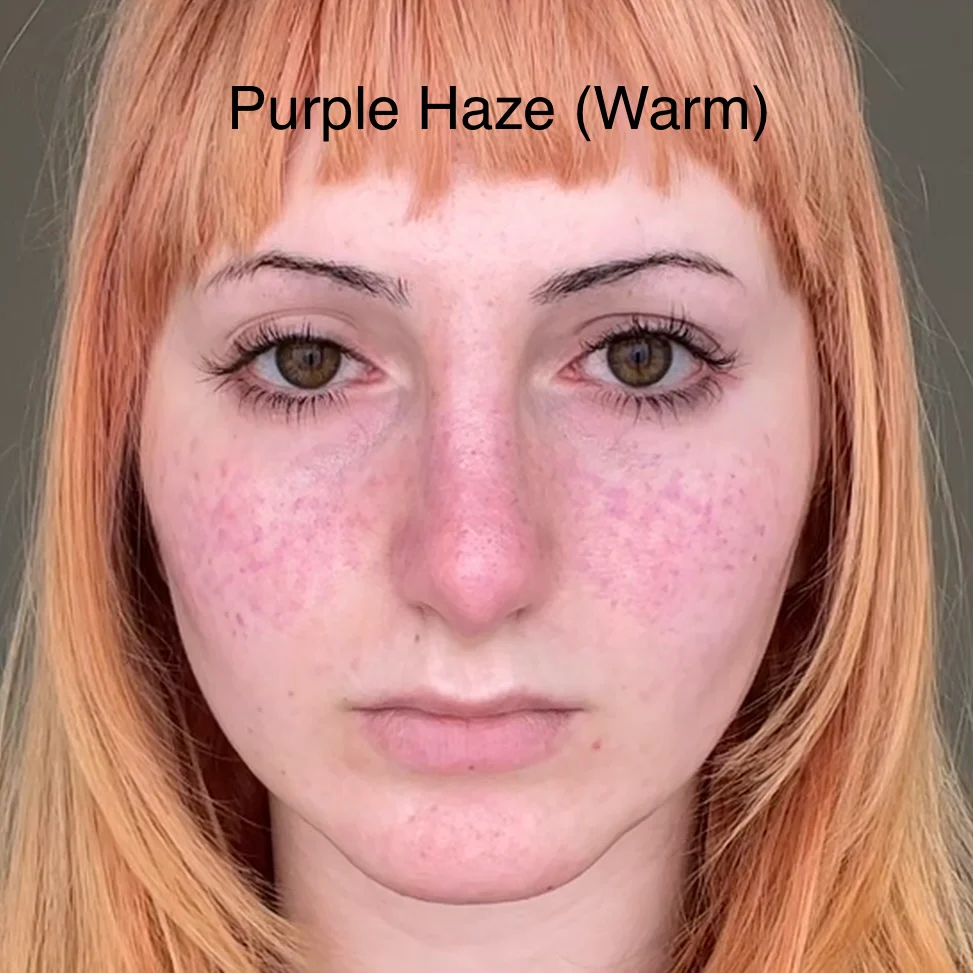 Freckle Pen - Image 8